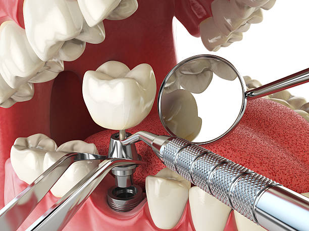Best Emergency Treatment for Dental Infections or Abscesses in City View, SC